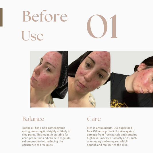 Glow Drops Face Oil - 30ml